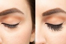 Before and After Eyelash Hair Transplant