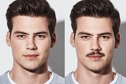Before and After Mustache Hair Transplant