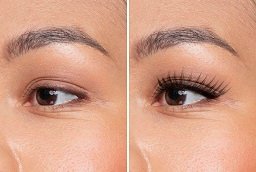 Eyelash Hair Transplant Before After