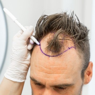 Front Line Hair Fixing Dubai