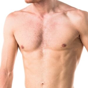 Body Hair Transplant Cost in Dubai