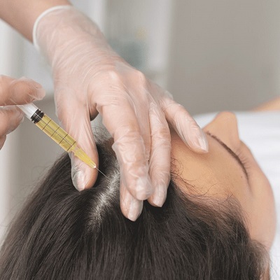 Hair Fillers Cost in Dubai