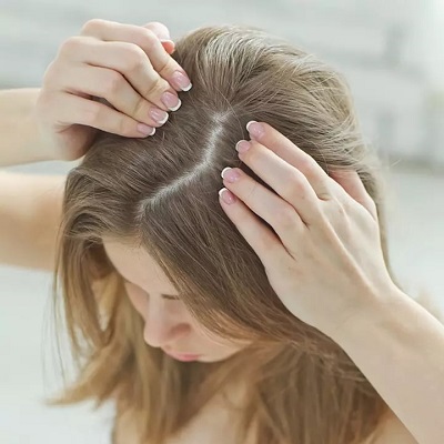 What Causes Hair Loss in Women