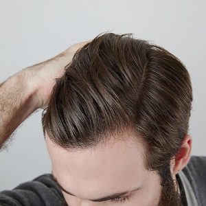 How to Prevent Hair Fall in Men