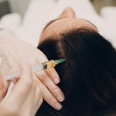 PRP Hair Treatment Reviews